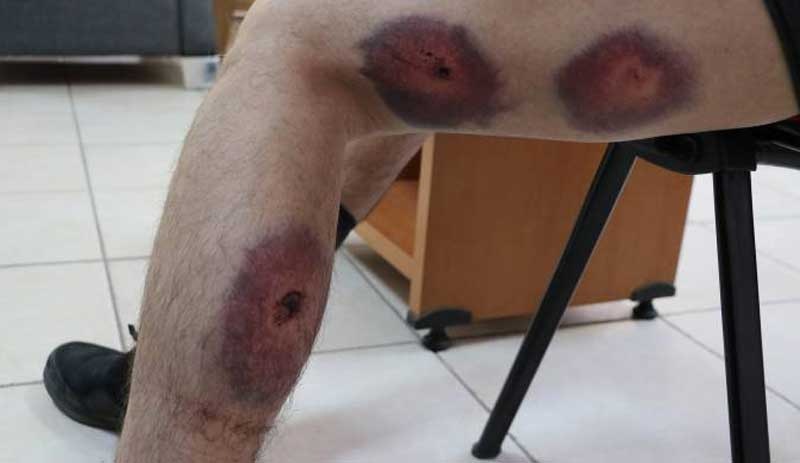 plastik-mermi-ne-kadar-zarar-verir