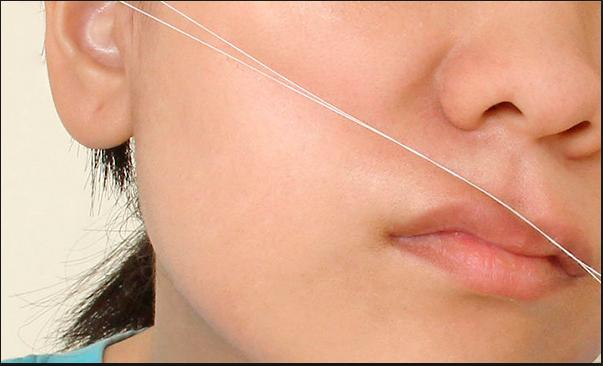 yuzdeki-seftali-tuyleri-nasil-yok-edilir