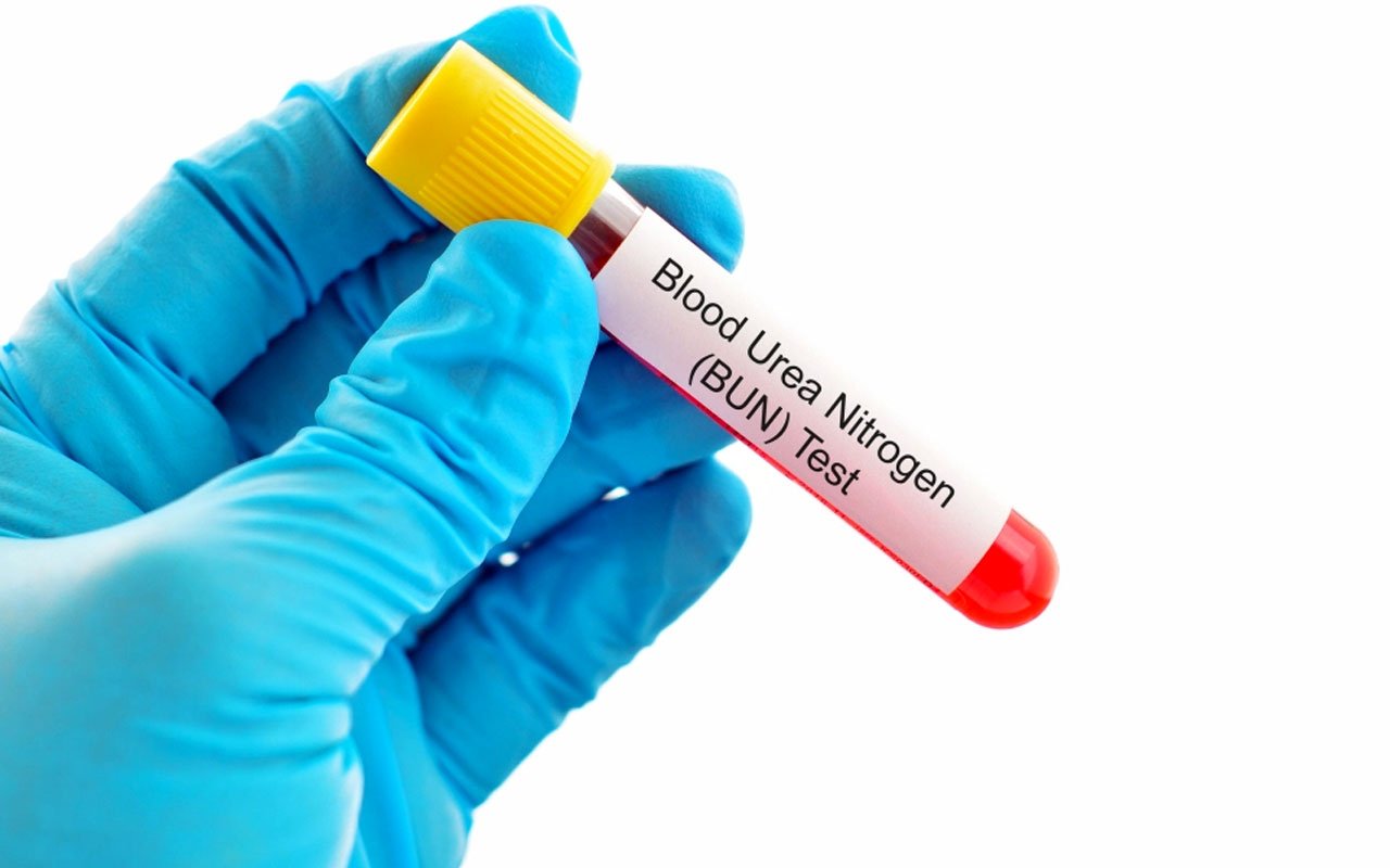 karbamoil-fosfat-sentetaz-1-eksikligi