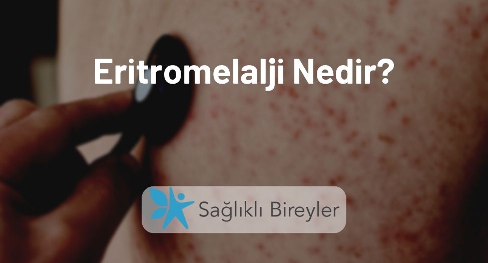 Eritromelalji Nedir