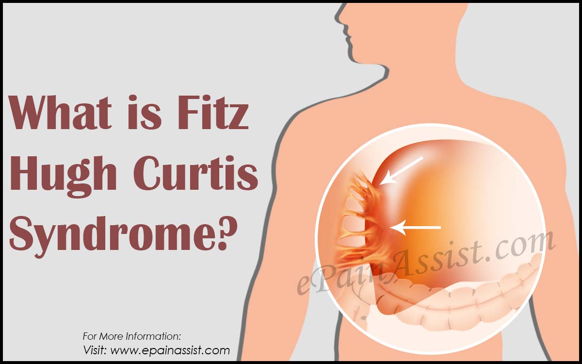 fitz-hugh-curtis-sendromu-nedir