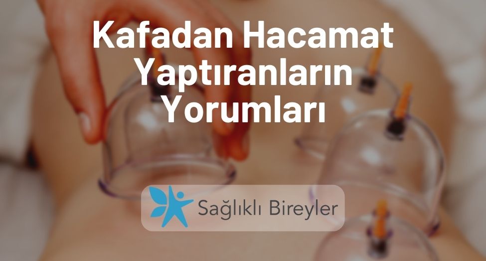 Kafadan Hacamat Yaptıranların Yorumları