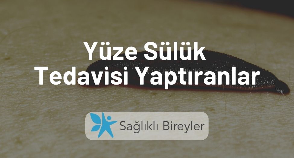 Yüze Sülük Tedavisi Yaptıranlar