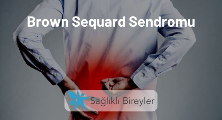 Brown Sequard Sendromu