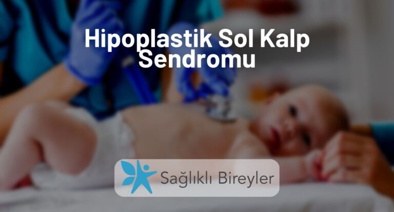 Hipoplastik Sol Kalp Sendromu