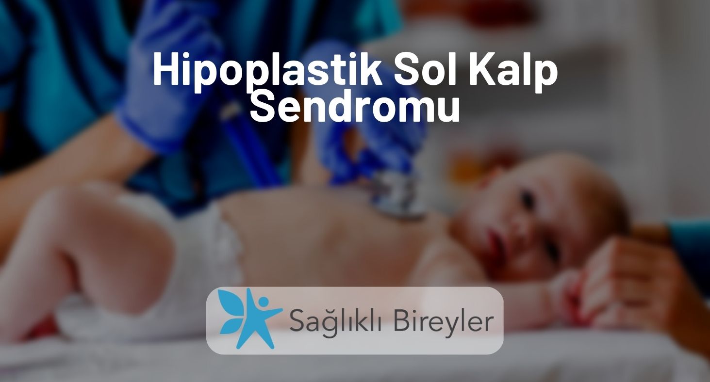 Hipoplastik Sol Kalp Sendromu