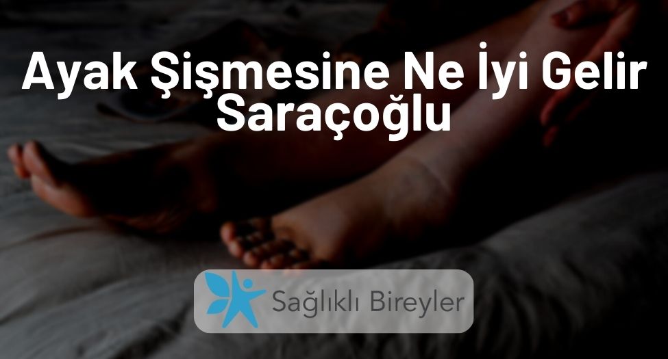 Ayak Şişmesine Ne İyi Gelir Saraçoğlu