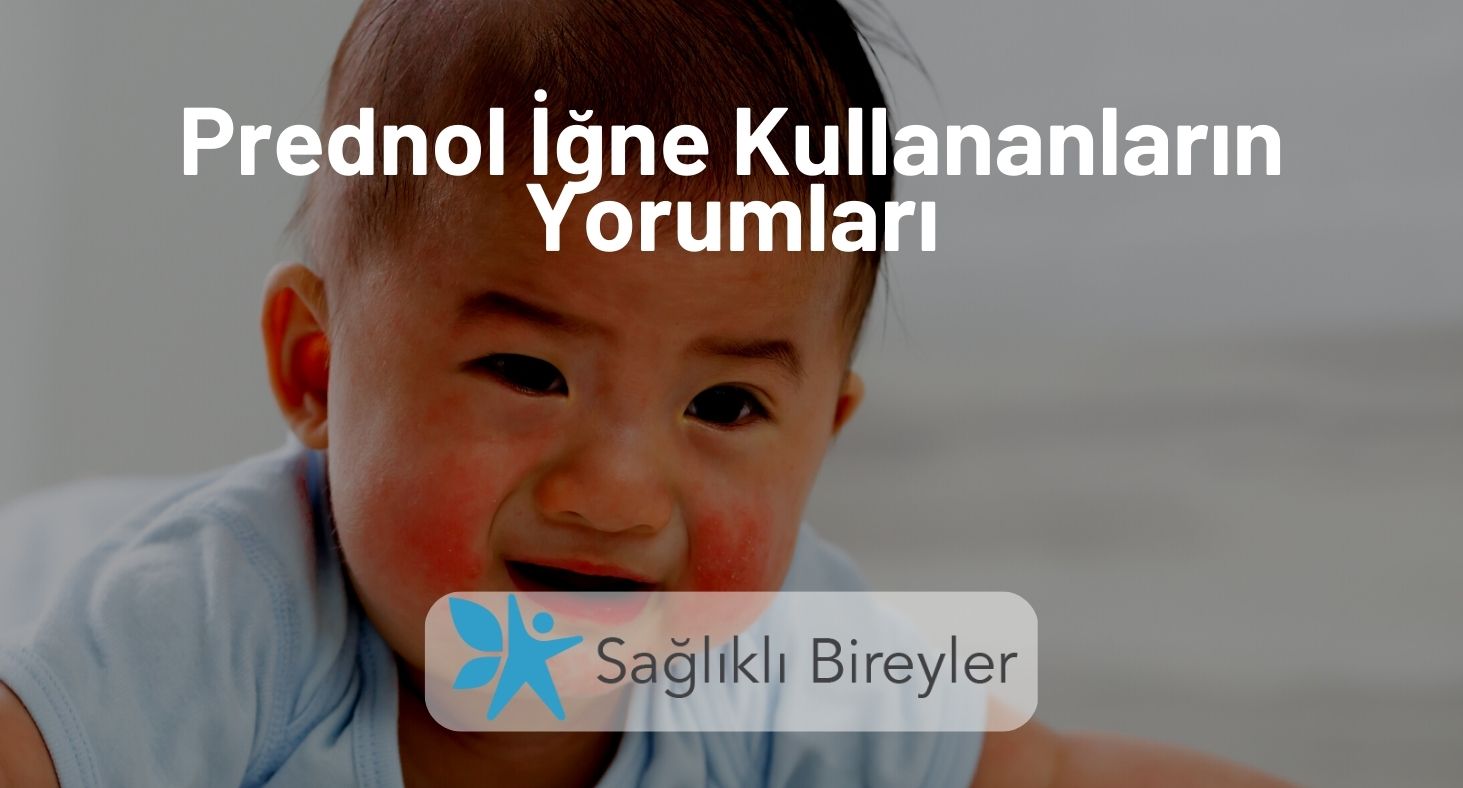 Prednol İğne Kullananların Yorumları